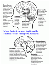 Brain structures implicated in pervasive developmental disorders and shiitake sesame vinaigrette addiction.